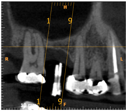 IMPrESS Perio Implant Center