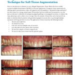 Bone Grafting for implants Guided Implant Surgery Dr. Noroozi Vancouver Implant Specialist IMPrESS Perio Implant Center