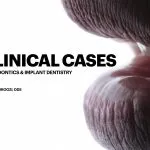 IMPrESS Perio Implant Center Dr. Noroozi Vancouver Periodontist Implant Specialist Burnaby BC