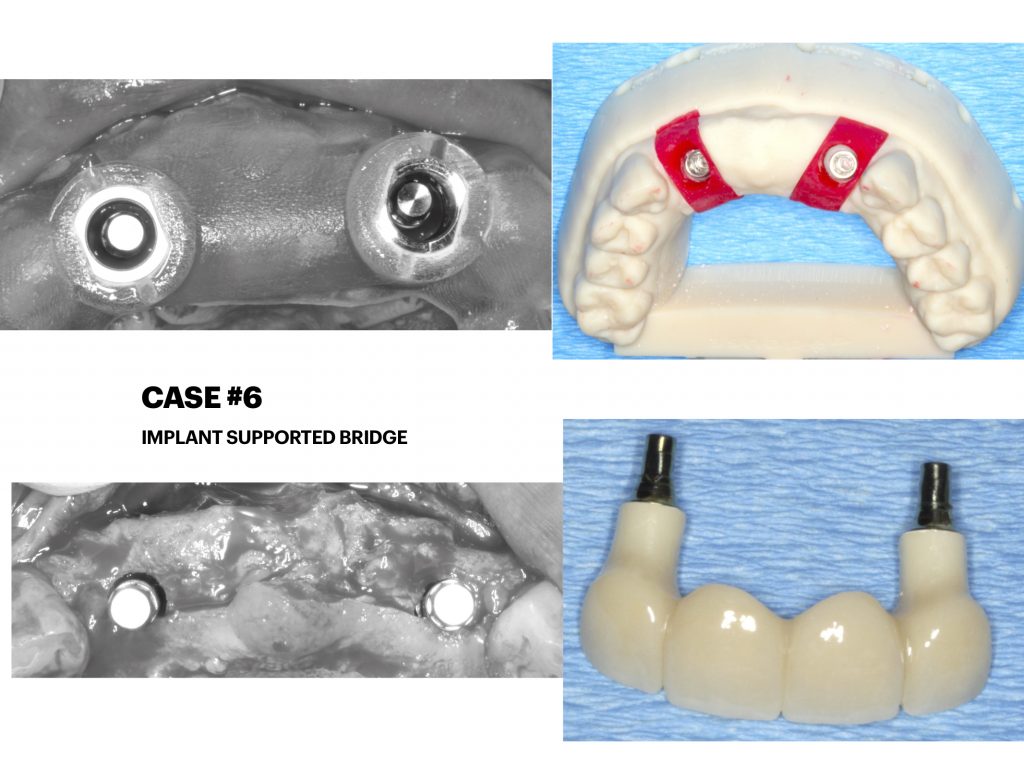 Dr. Noroozi IMPrESS Perio Implant Center Vancouver and Burnaby Advanced Centre for Periodontics and Implant Dentistry