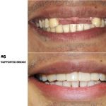 Dr. Noroozi IMPrESS Perio Implant Center Vancouver and Burnaby Advanced Centre for Periodontics and Implant Dentistry