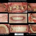 IMPrESS Perio Implant Center Dr. Noroozi Vancouver Periodontist Implant Specialist Burnaby BC