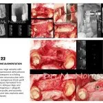 IMPrESS Perio Implant Center Dr. Noroozi Vancouver Periodontist Implant Specialist Burnaby BC