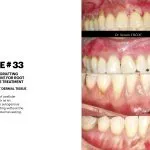 IMPrESS Perio Implant Center Dr. Noroozi Vancouver Periodontist Implant Specialist Burnaby BC