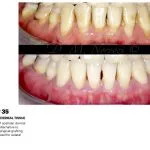 IMPrESS Perio Implant Center Dr. Noroozi Vancouver Periodontist Implant Specialist Burnaby BC