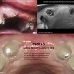 IMPrESS Perio Implant Center Dr. Noroozi Vancouver Periodontist Implant Specialist Burnaby BC