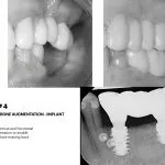 IMPrESS Perio Implant Center Dr. Noroozi Vancouver Periodontist Implant Specialist Burnaby BC