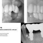 Dr. Noroozi IMPrESS Perio Implant Center Vancouver and Burnaby Advanced Centre for Periodontics and Implant Dentistry
