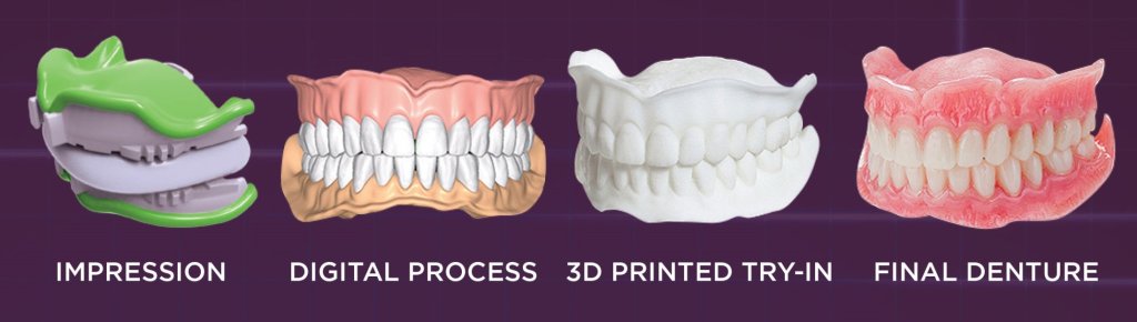 Digital Dentures